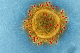 yellow virus with red dots on blue background